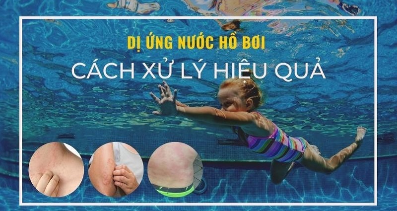 Cách xử lý dị ứng nước bể bơi 